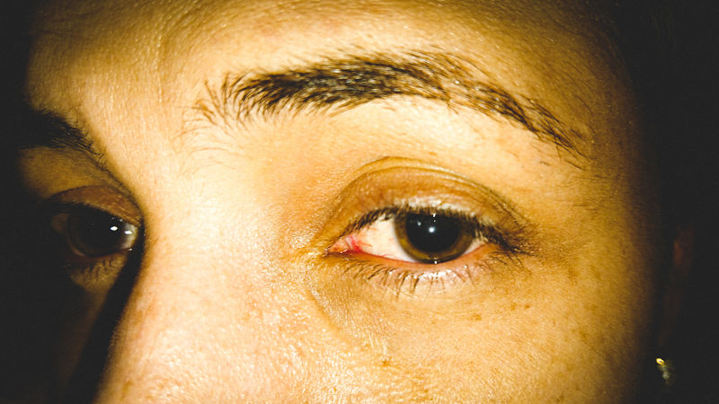 como quitar pupilas dilatadas por droga